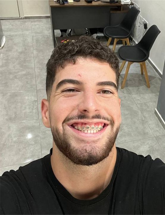 Enes Pllana